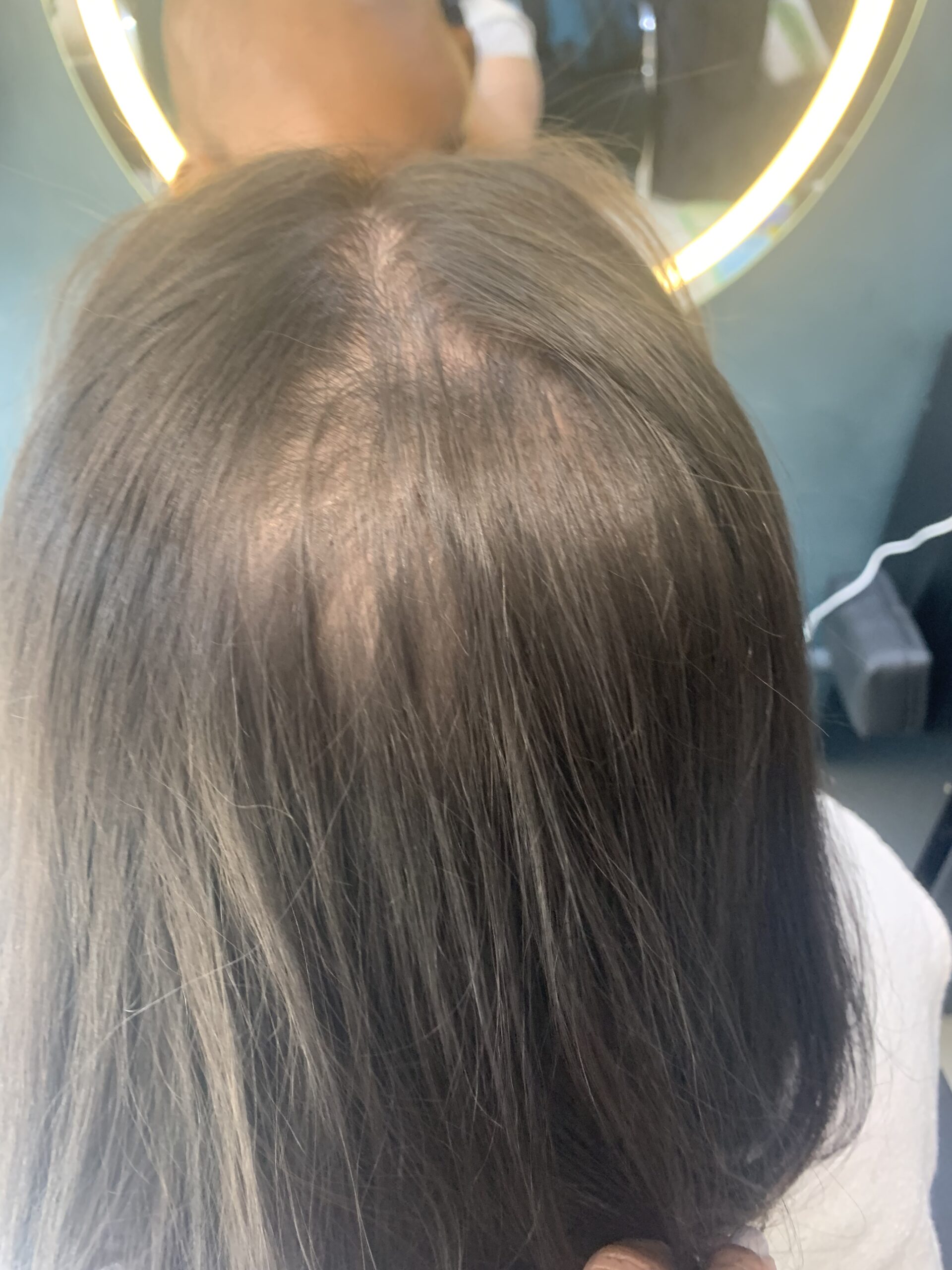 Queda de Cabelo no Tatuapé | Tratamento Eficaz no Jack Oliveira Queda de Cabelo no Tatuapé | Tratamento Eficaz no Jack Oliveira